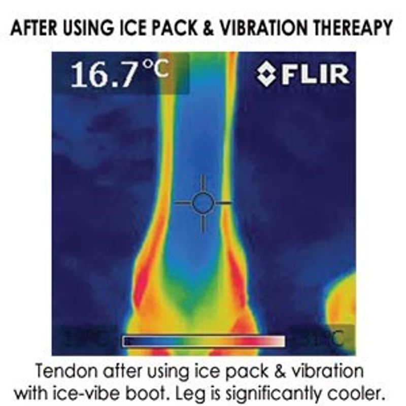 Ice-Vibe Hock Wrap